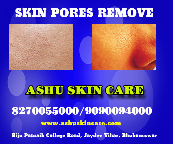 best skin pores remove treatment clinic in bhubaneswar near hitech hospital